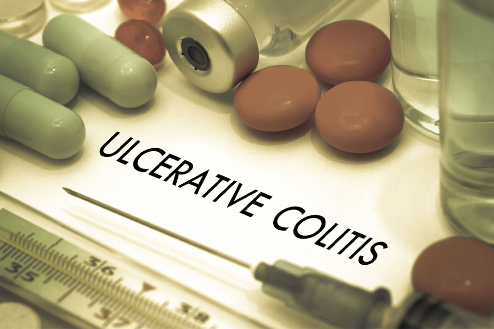 Ulcerative Colitis – Risk Factors and Early Signs